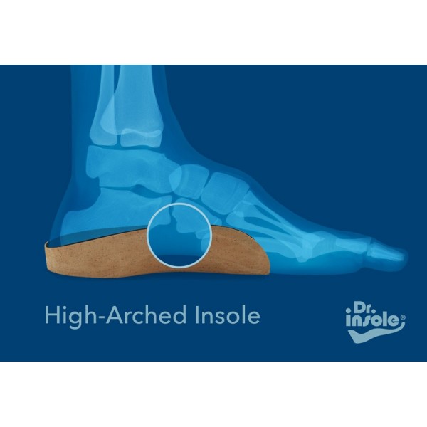 Custom Made Insoles for High Arches