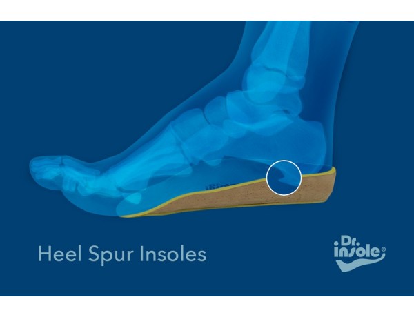 Custom made Insoles for Heel Spurs