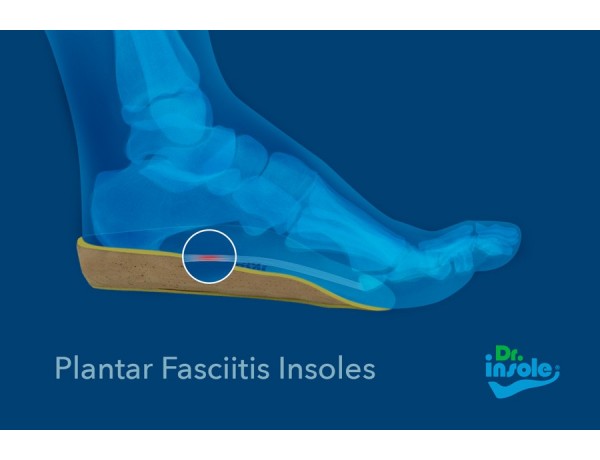 plantar fascia insoles