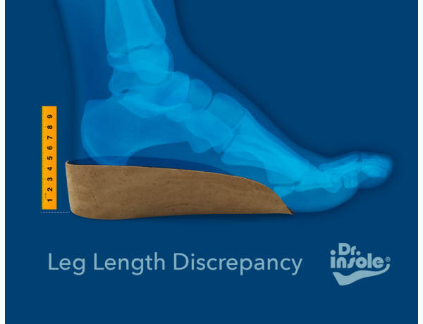 Heel Raises for Leg Length Discrepancy