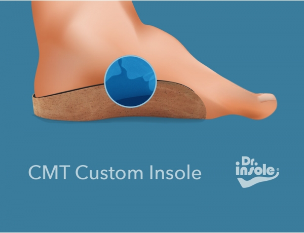 Custom made insoles for CMT