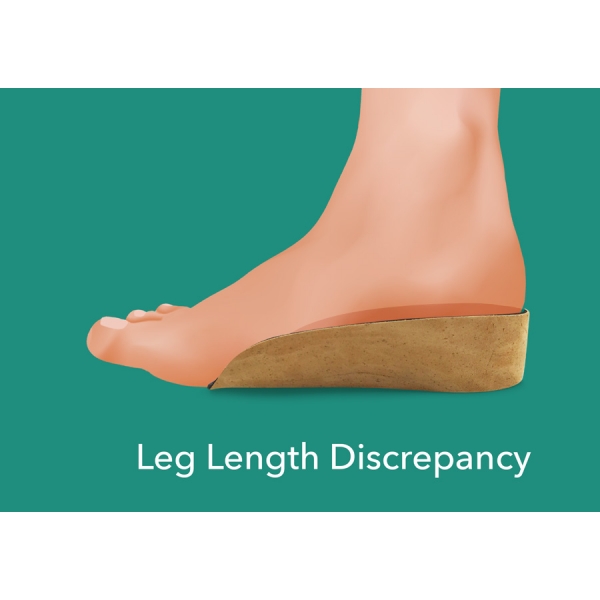Heel Raises (Discrepancy)