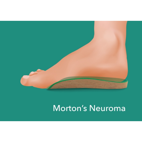 morton's toe insoles