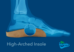 high arches medical orthotics