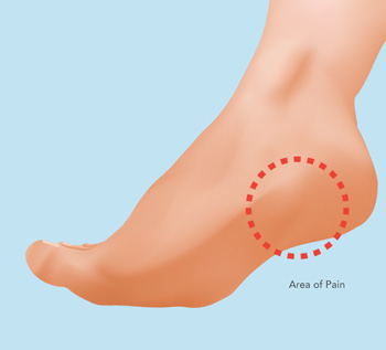 area of pain