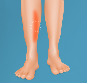 shin splits illustration