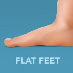 Flat Feet Orthotics