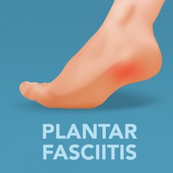 Illustration showing heel pain from plantar fasciitis and the affected area of inflammation.
