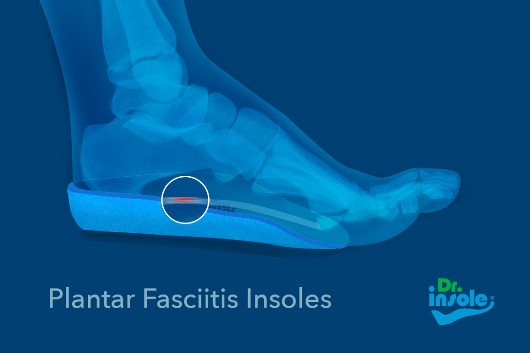 custom-insoles-for-plantar-fasciitis