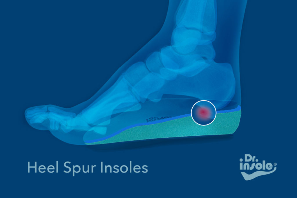 custom made insoles for heel spur
