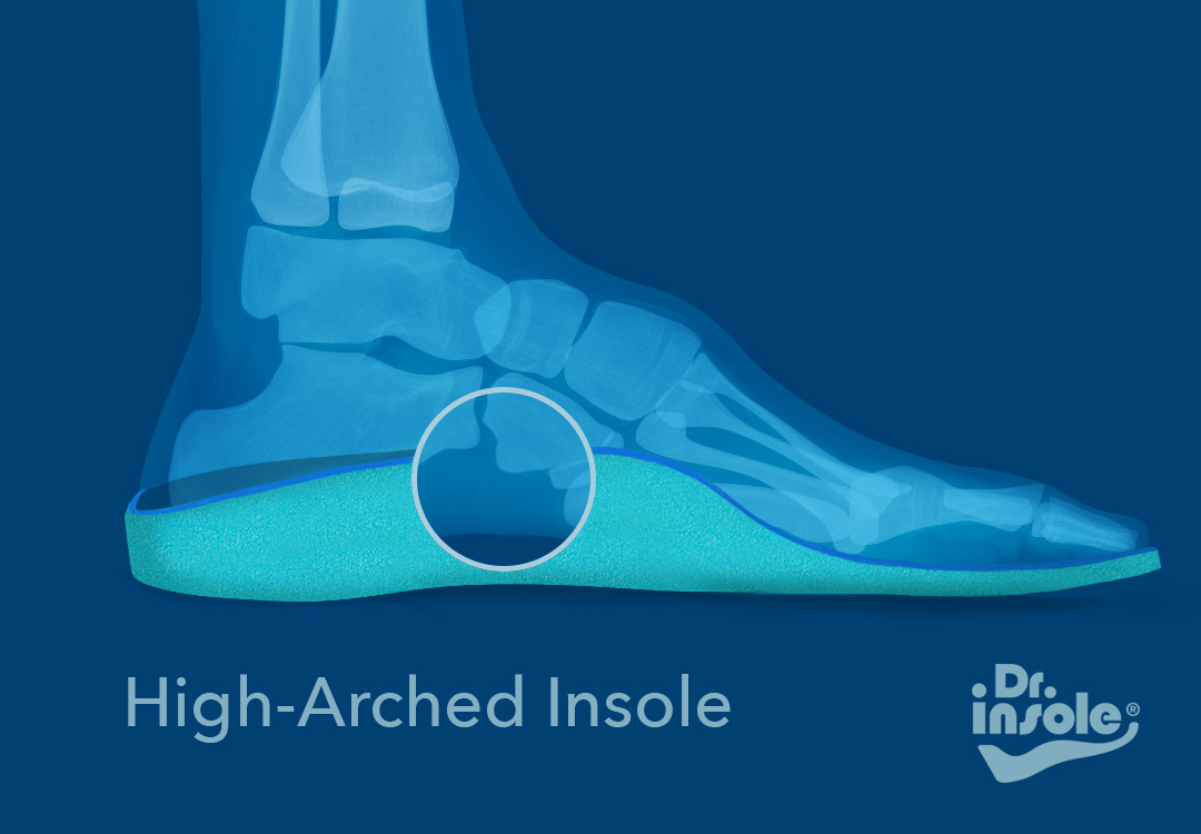 custom-made-orthotics-for-high-arches