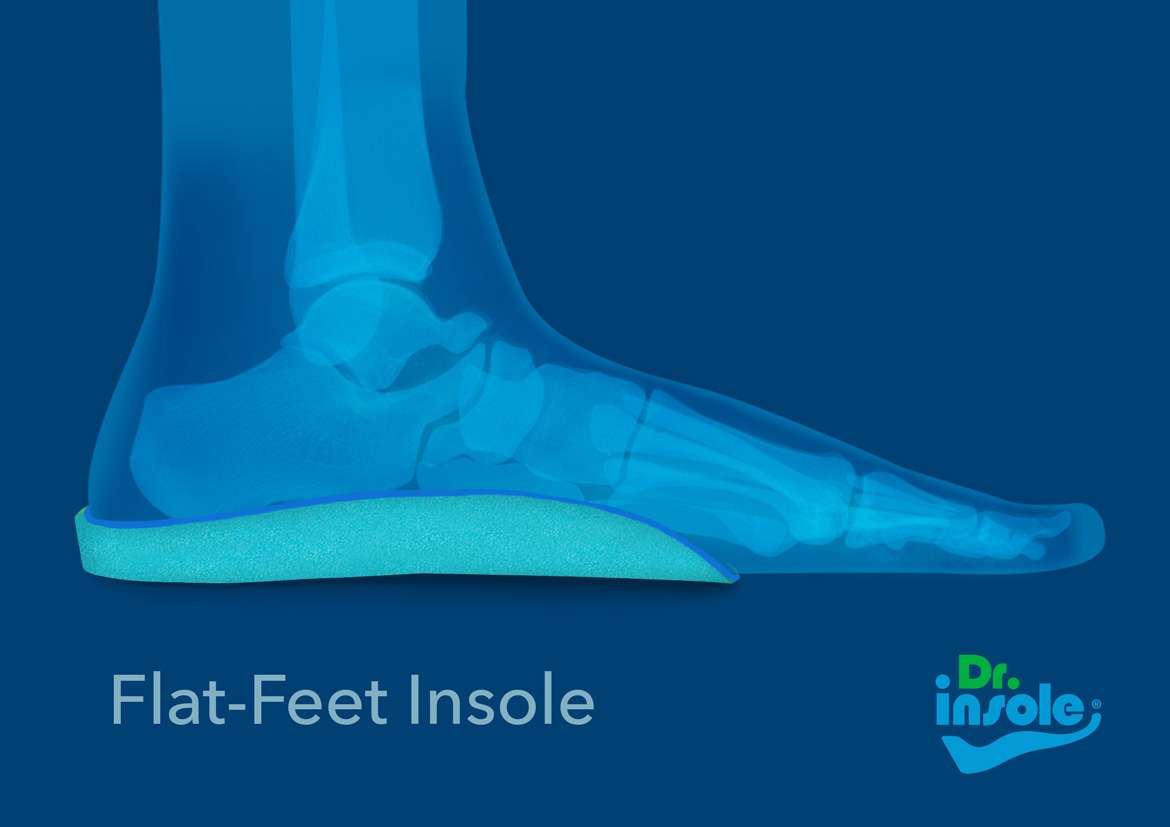 custom orthotic insoles for flat feet